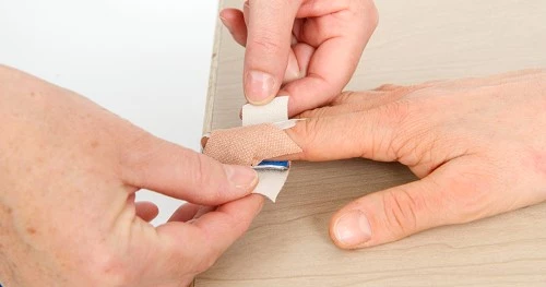 Påfør et nyt stykke plaster, som dækker den sidste del af skinnen