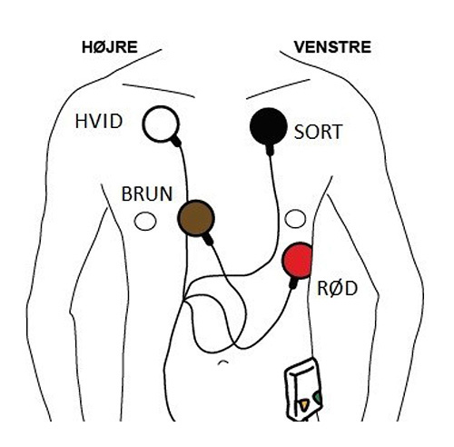 Illustration af, hvor de forskellige elektroder skal sidde