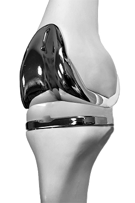 Model af knæ med helprotese