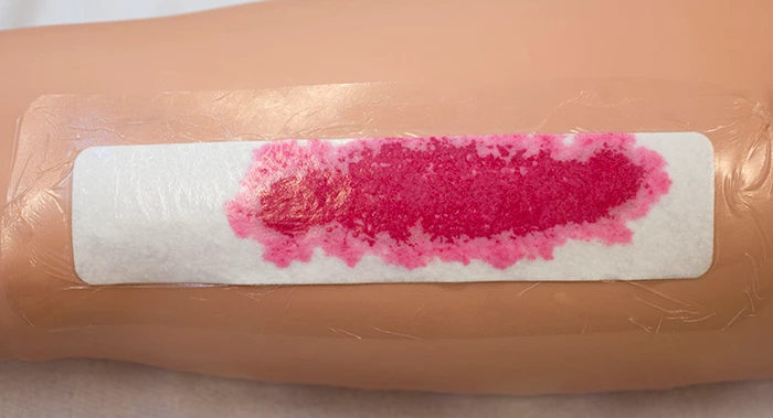 Plaster, der er mere end to tredjedele gennemsivet